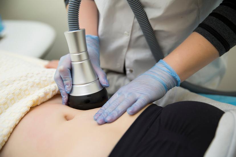 Cavitation Ultrasound RF